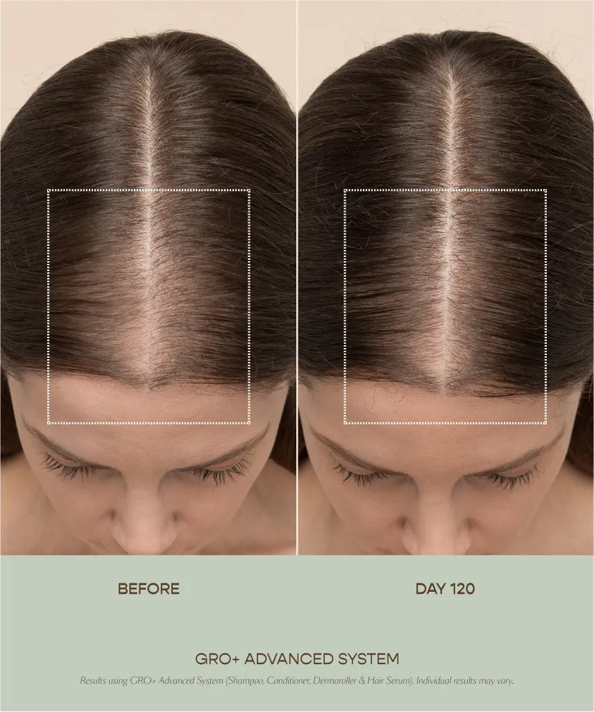 GRO  Advanced Hair Serum (3 Pack)