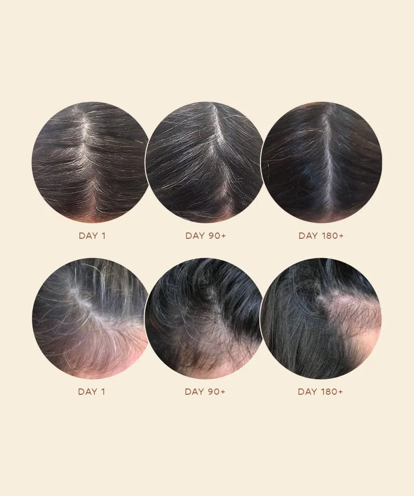 GRO AGELESS Anti-Gray Hair Serum (3 Pack)